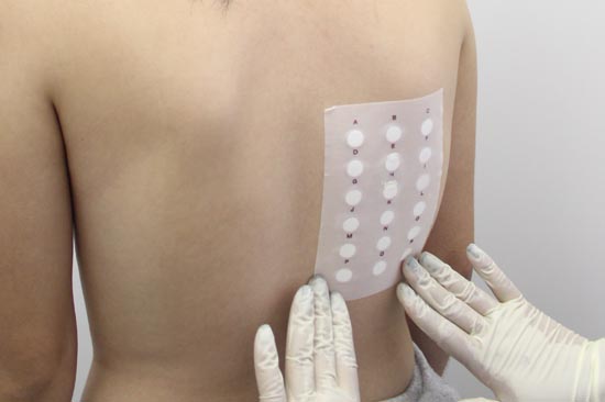 Patch Test for Cosmetics